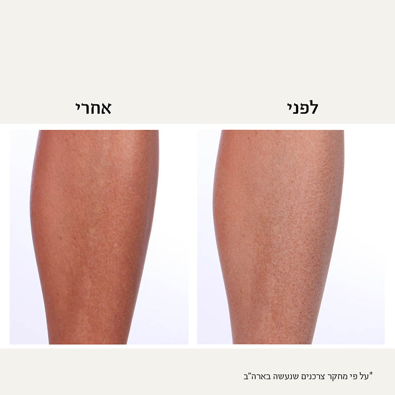 קרם גוף טיפולי ™GreenAid