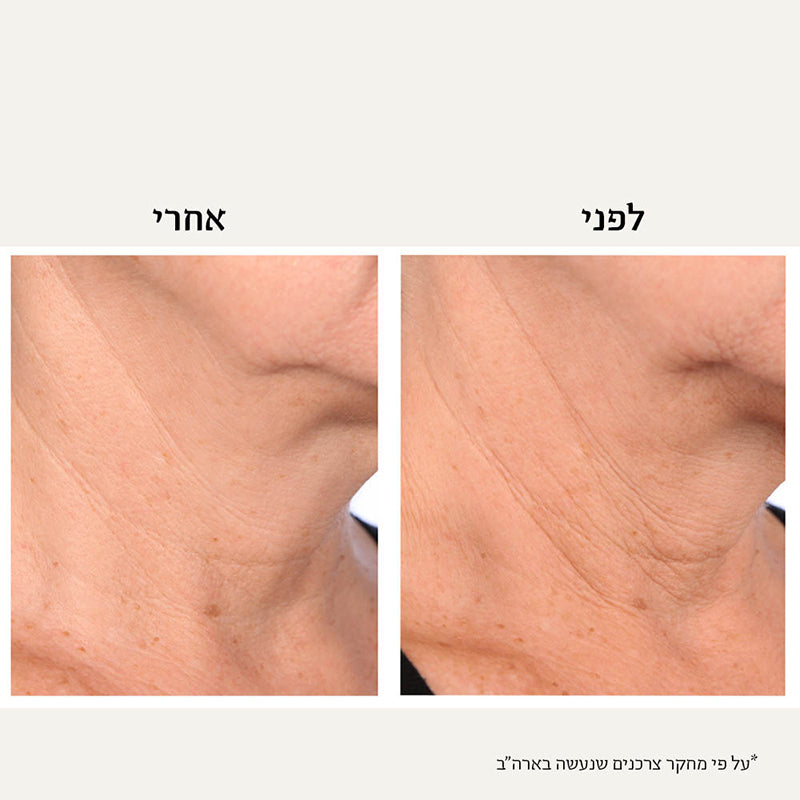 קרם צוואר | למיצוק והפחתת קמטים