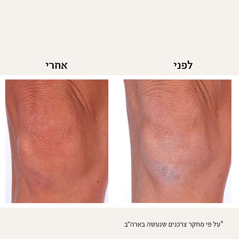 קרם גוף טיפולי ™GreenAid