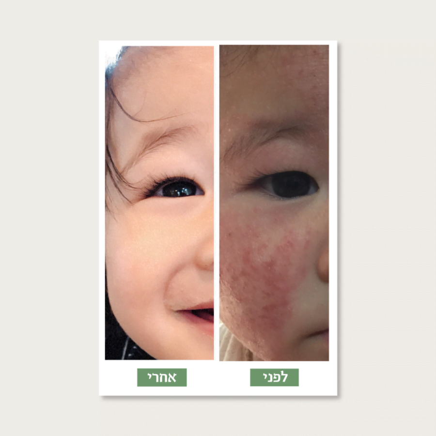 Web Before After.png