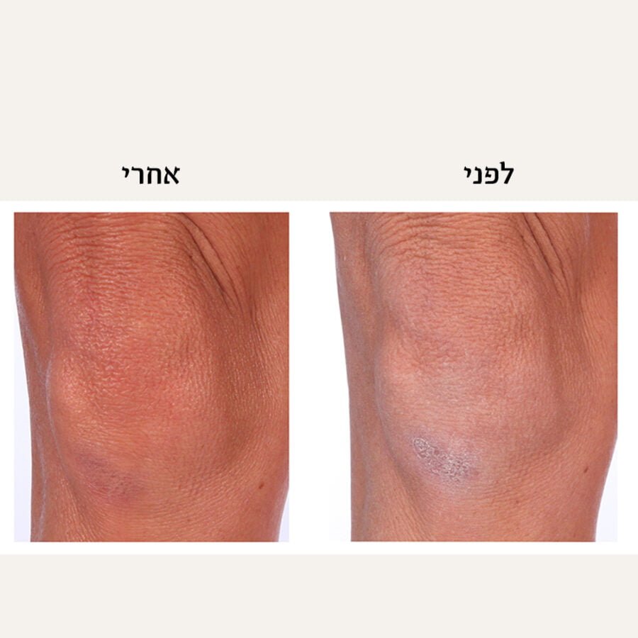 Thera Body Cream Ba2.jpg